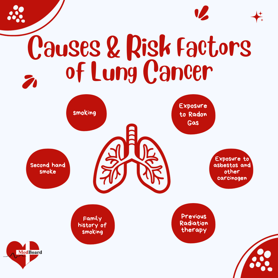 Causes and Risk factors of lung cancer